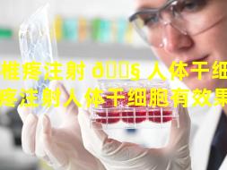 颈椎疼注射 🐧 人体干细胞（颈椎疼注射人体干细胞有效果吗）